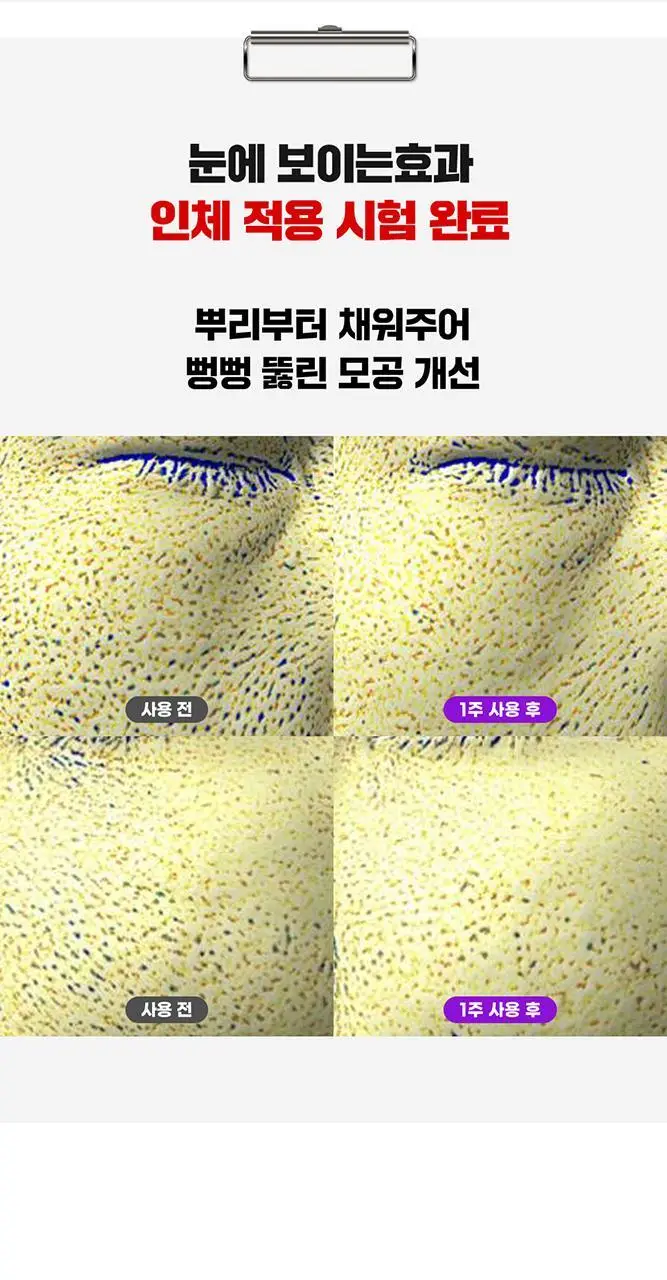 [단독기획/PDRN] 파티온 노스카나인 트러블 모공탄력 크림 45ml 기획(+15ml) 상세페이지 19